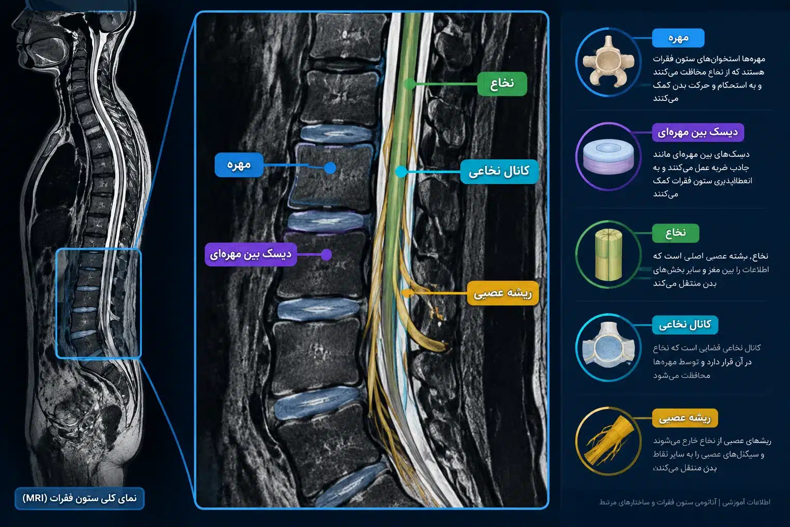 آناتومی ستون فقرات در MRI با نمایش مهره‌ها و دیسک‌ها