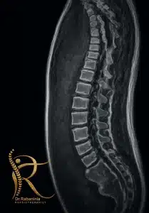 عکس شاخص مقاله تشخیص MRI