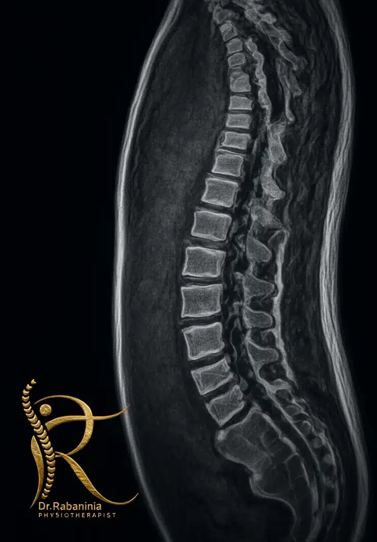 عکس شاخص مقاله تشخیص MRI